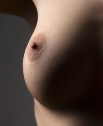 Les différentes techniques pour la reconstruction mammaire