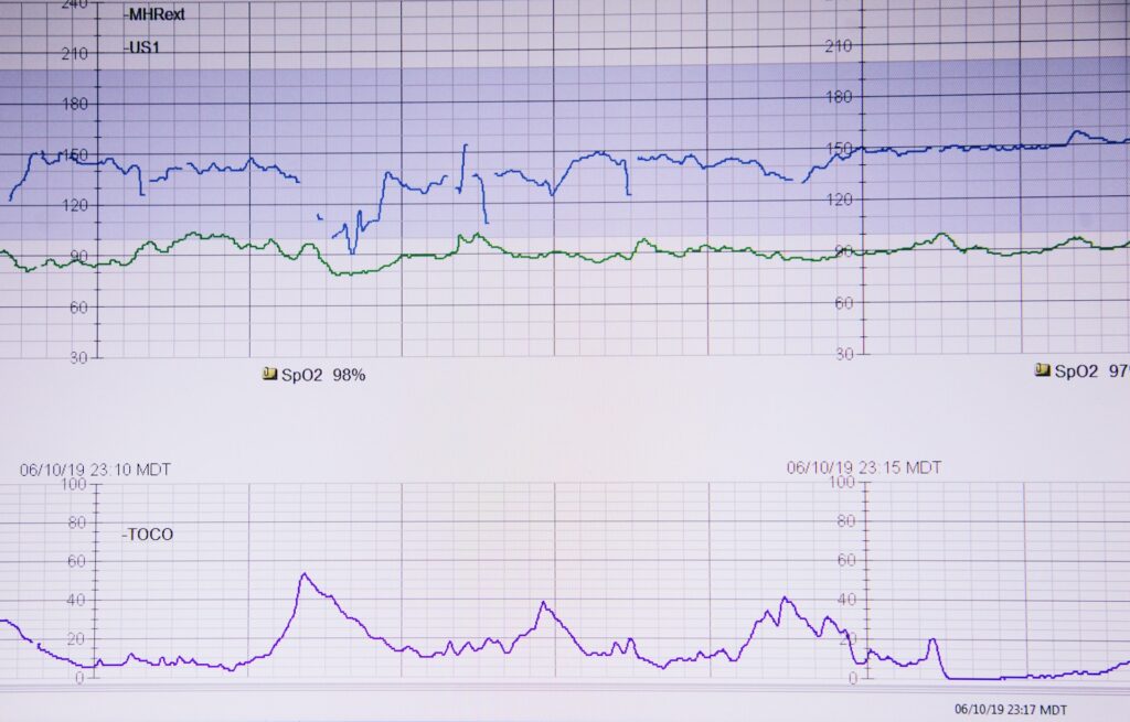 Quand consulter un cardiologue ?